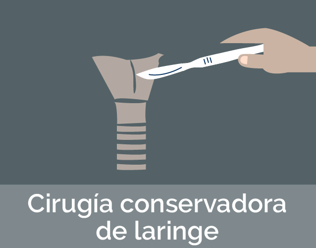 Cirugía Conservadora De Laringe Medellin Colombia Doctor Zaki